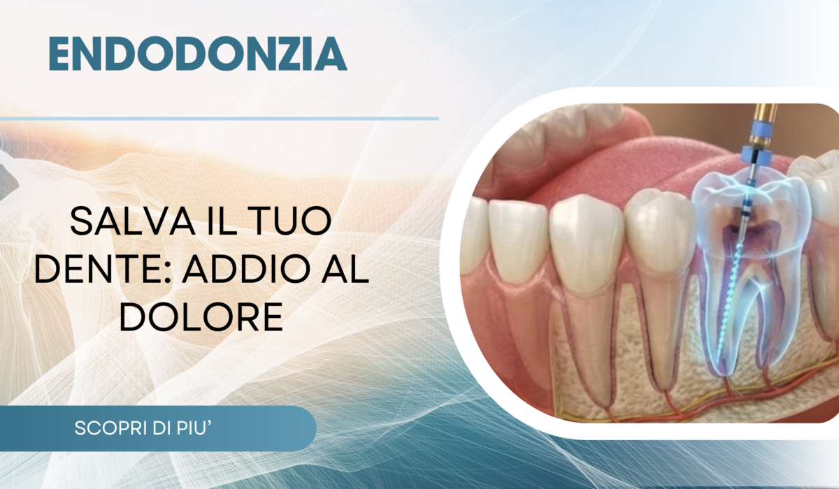 Trattamenti estetici dentali e sbiancamento