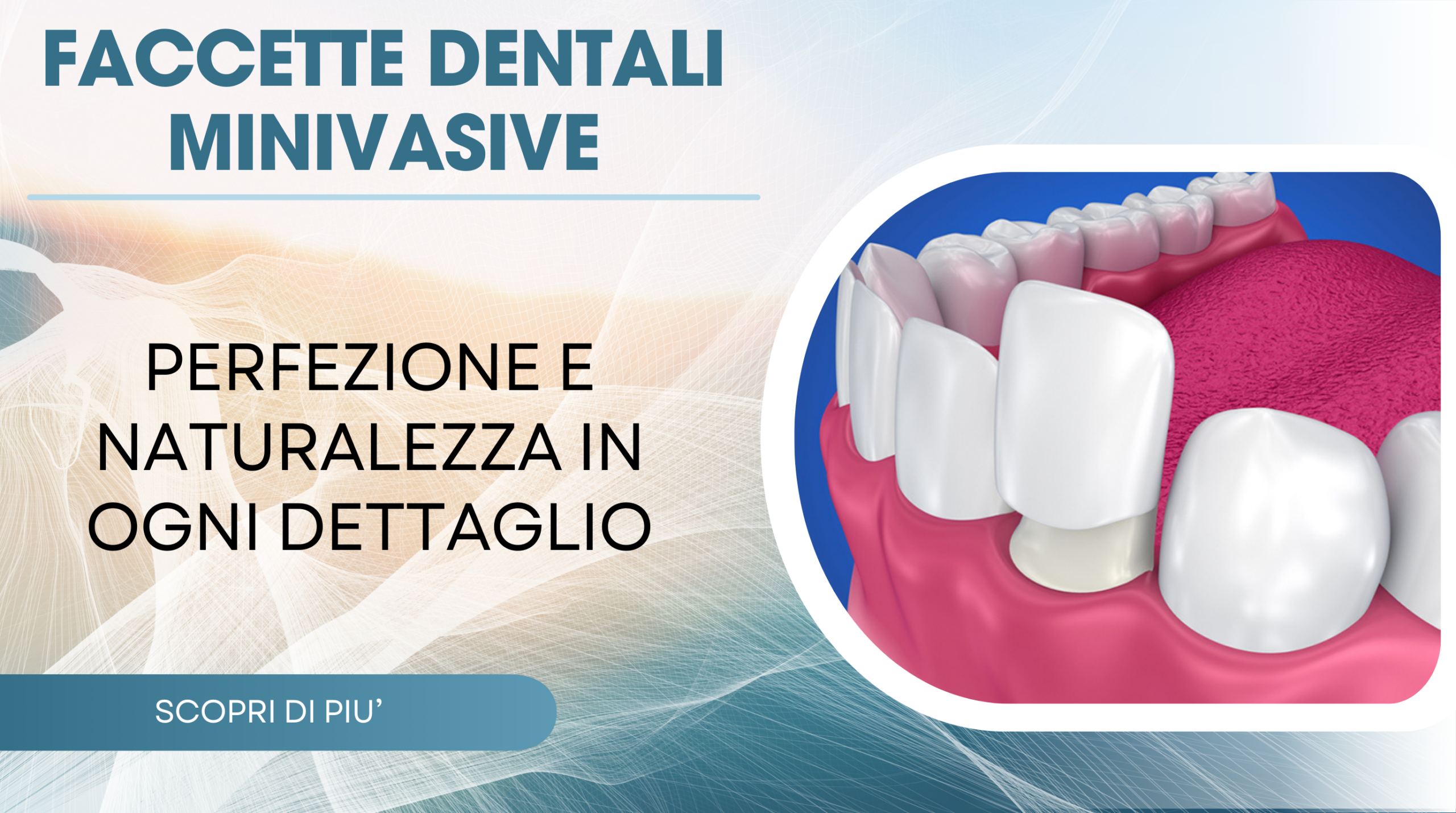 Trattamenti ortodontici personalizzati